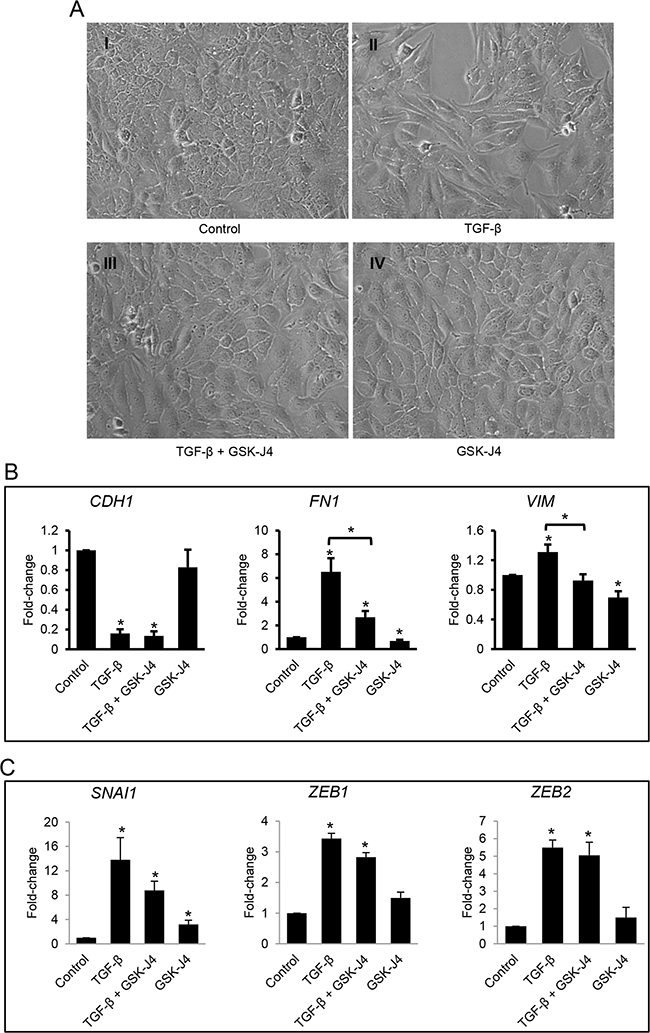 Effects of the JMJD3 and UTX inhibitor GSK-J4 on TGF-&#x03B2;-induced EMT in ovarian cancer cells.