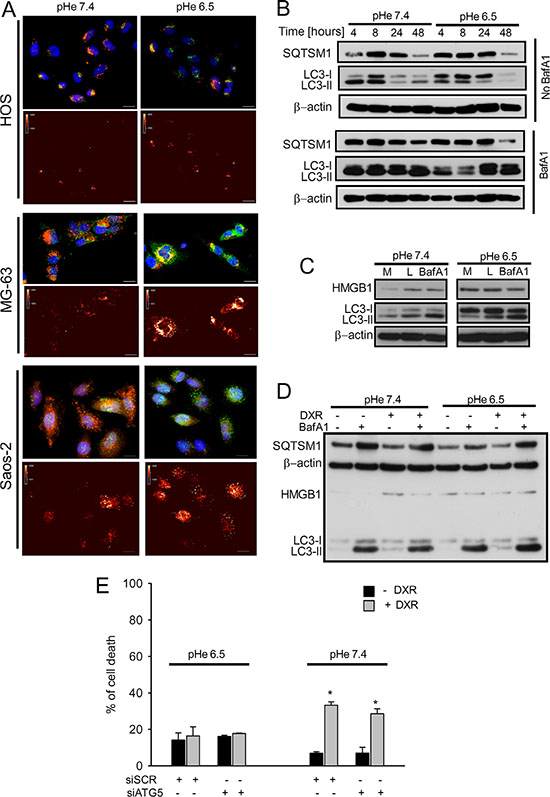 Autophagic flux was unaffected in OS cells cultured under acidic conditions.