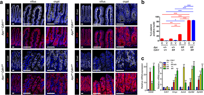 Combined Vil-CreERT2 with Apc and Cdh1 homozygous floxed alleles results in &#x03B2;-catenin nuclear localization and activation of Wnt target genes.