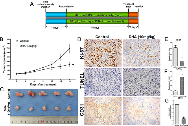 DHA decreases proliferation and angiogenesis and increases apoptosis in pancreatic cancer cells in vivo.