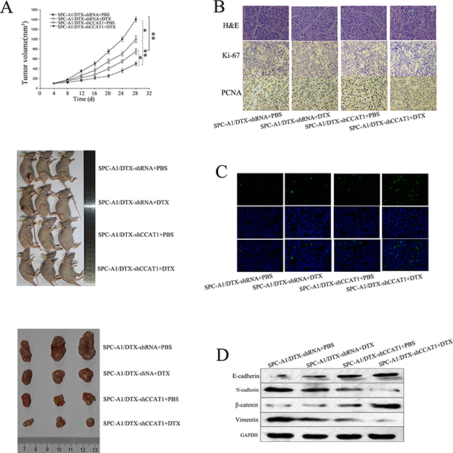 Effect of CCAT1 on chemoresistance and EMT of docetaxel-resistant LAD cells in vivo.
