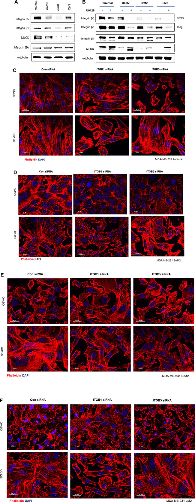 Integrin &#x03B2;1 mediates stress fiber formation and AKT activation following MEK inhibition.