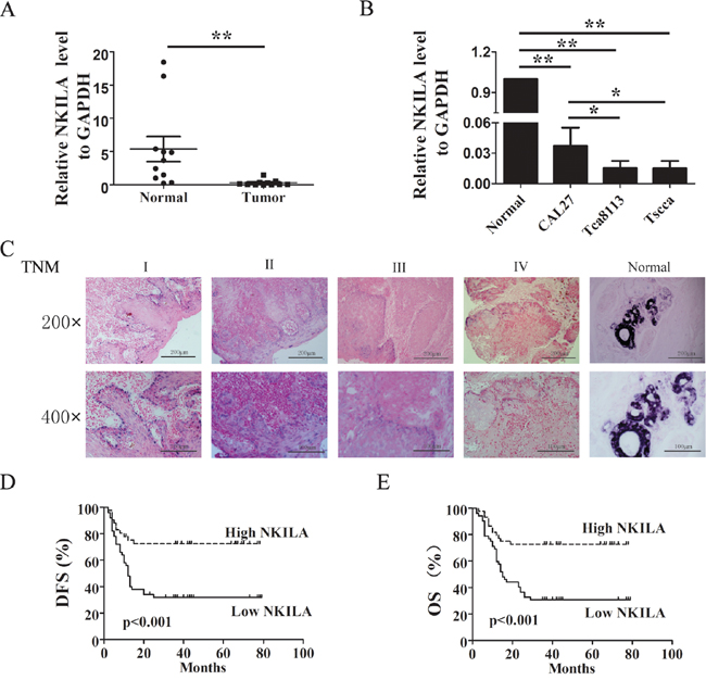 Relative NKILA expression in TSCC and its relationship with patients prognosis.