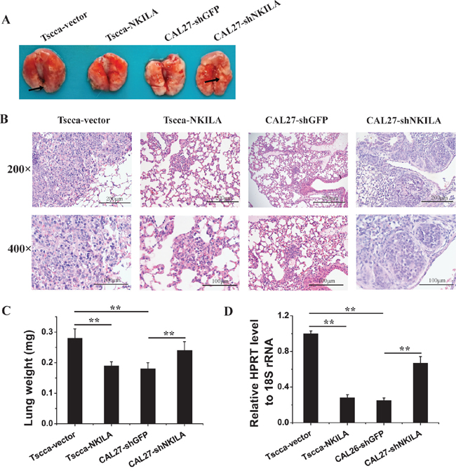 NKILA negatively regulates TSCC cells metastasis in NOD/SCID mice.