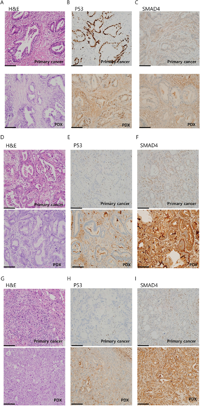 Immunohistochemistry (IHC) analysis of patient-derived xenograft (PDX)-primary tumor pairs reveals a conserved histology.