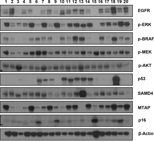 Western blots showing the expression levels of various growth signaling and cell cycle regulatory proteins.