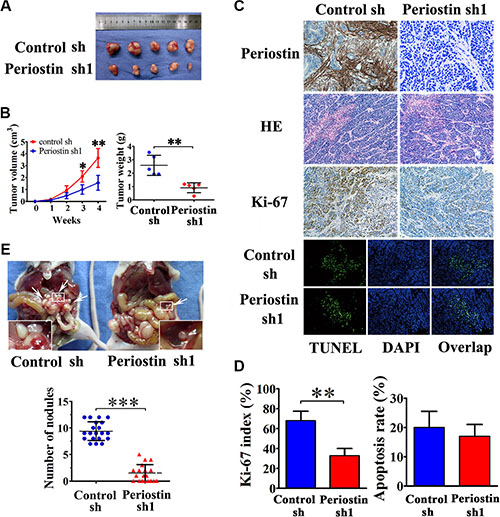 Periostin enhances the tumorigenicity of pancreatic cancer cells in vivo and promotes metastasis.