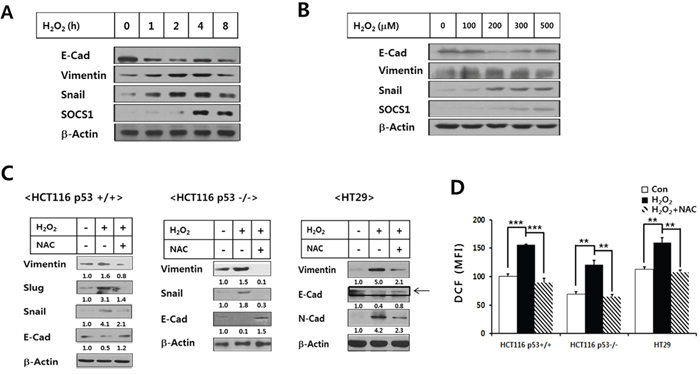Regulation of EMT markers and SOCS1 expression by H2O2 and effects of NAC on H2O2-induced ROS and EMT markers in colon cancer cell lines.