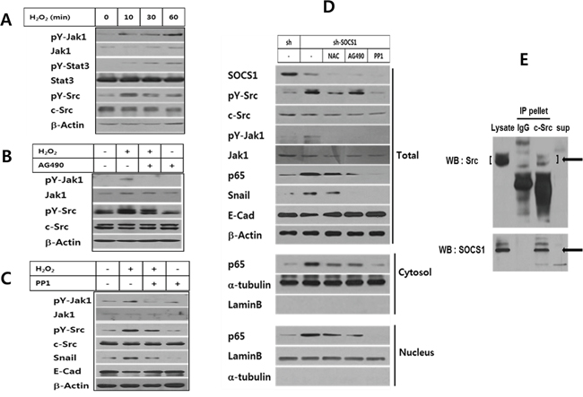 ROS-induced Jak and Src participate in EMT signaling, which are regulated by SOCS1.