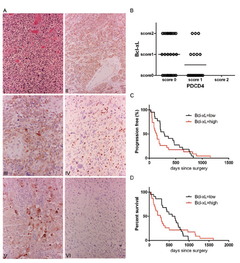 Patient GBM tumors show a correlation between low PDCD4 and high Bcl-xL levels.