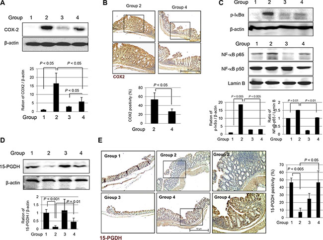 Expression changes of COX-2, NF kB and 15-PGDH according to experimental groups.