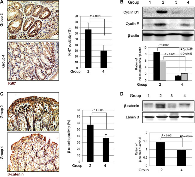 The changes of Ki-67, Cyclins, and &#x03B2;-catenin according to group (A) Immunohistochemical staining of Ki67 (Magnification at &#x00D7; 100).