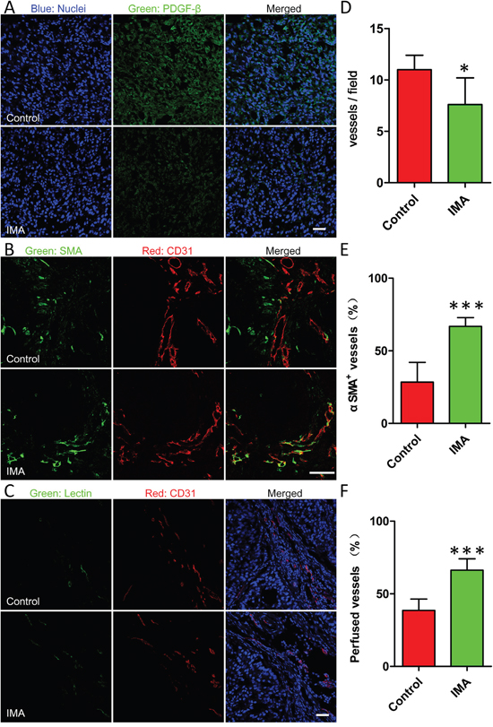 Effects of IMA treatment on the tumor microenvironment including