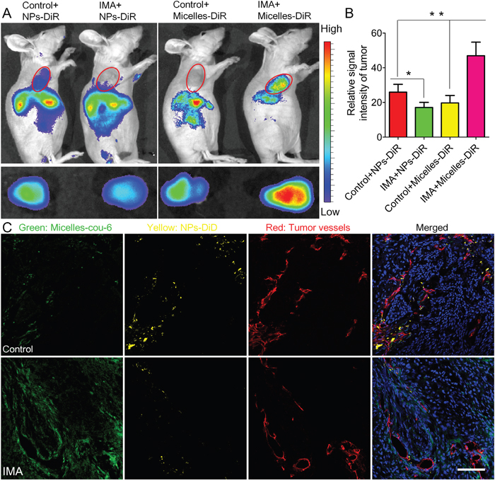 The effects of IMA treatment on tumor nanomedicine delivery.