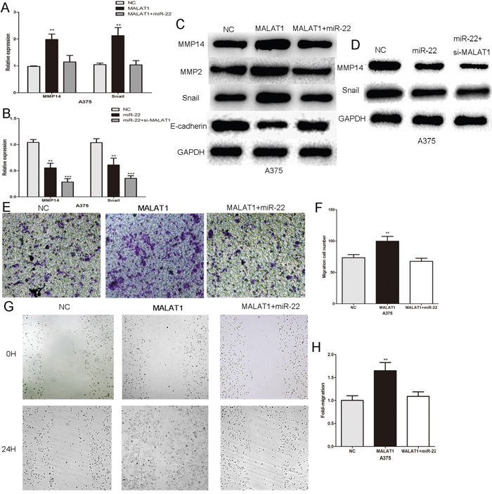 MALAT1 promotes melanoma cell growth and metastasis by acting as a ceRNA.