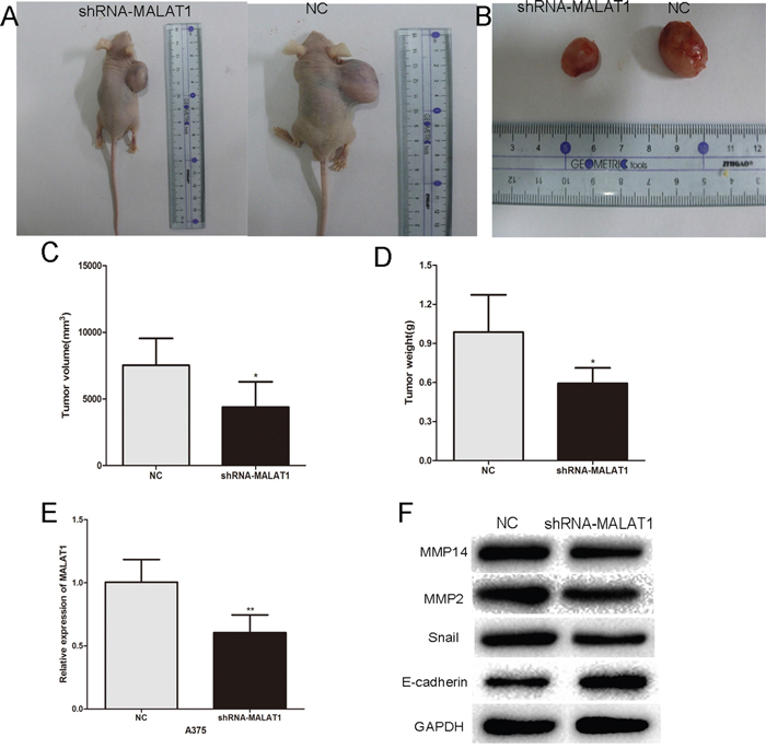 Inhibition of endogenous MALAT1 expression by siRNA inhibits melanoma growth in vivo.