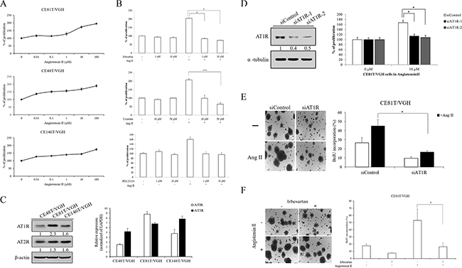 Angiotensin II induced cell proliferation of ESCC was required for AT1R.