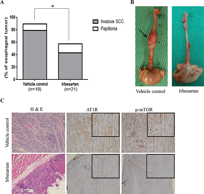 Inhibitory effect of irbesartan in 4-NQO-induced ESCC murine model.