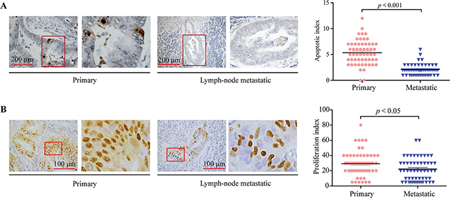 TUNEL and Cyclin D1staining assays on primary CRC and colorectal lymphatic metastasis specimens.