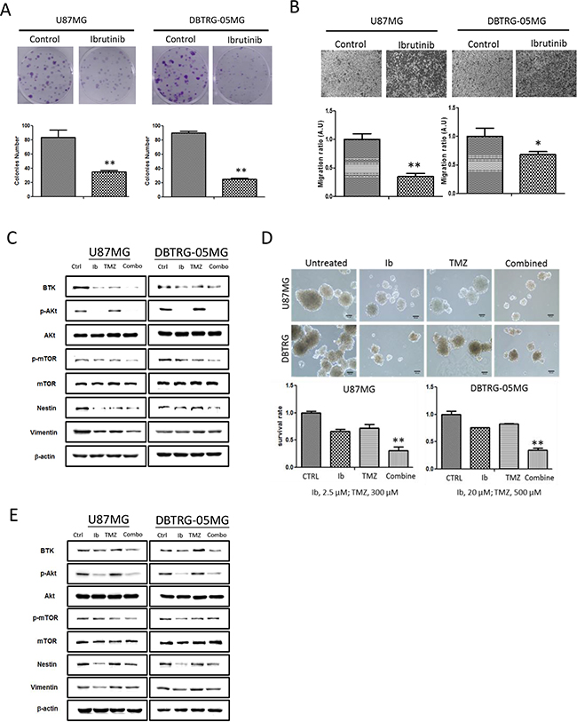 Figure 4. Ibrutinib suppressed GBM tumorigenic ability resembling Btk-gene silenced GBM cells.