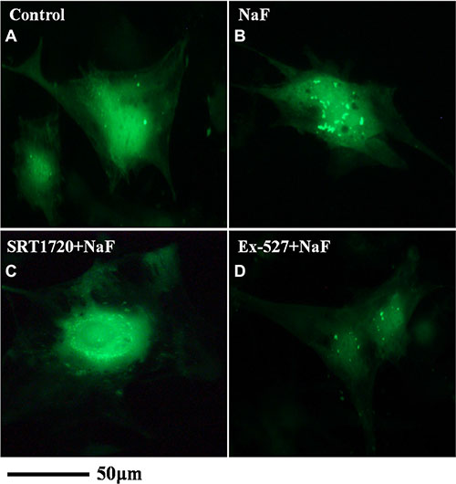 Fluorescence microscope analysis was performed to evaluate autophagy in cells treated with NaF alone, pre-incubated with SRT1720 or pre-incubated with Ex-527.