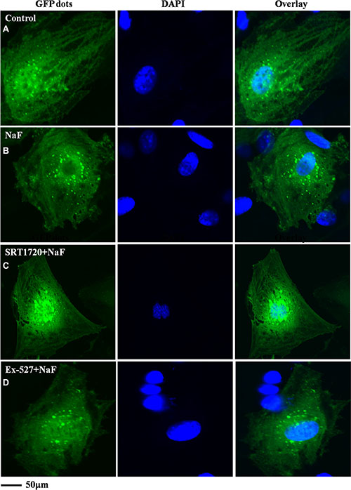 Confocal microscope analysis was performed to evaluate autophagy in cells treated with NaF alone, pre-incubated with SRT1720 or pre-incubated with Ex-527.