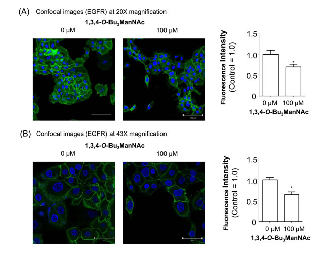Confocal imaging of EGFR in SW1990 cells treated with 1,3,4-