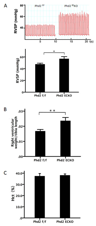 Development of pulmonary hypertension in PHD2