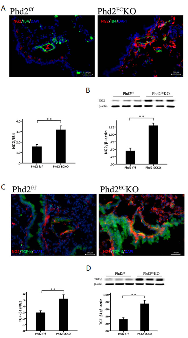 The recruitment of pericyte in the pulmonary arteriole.