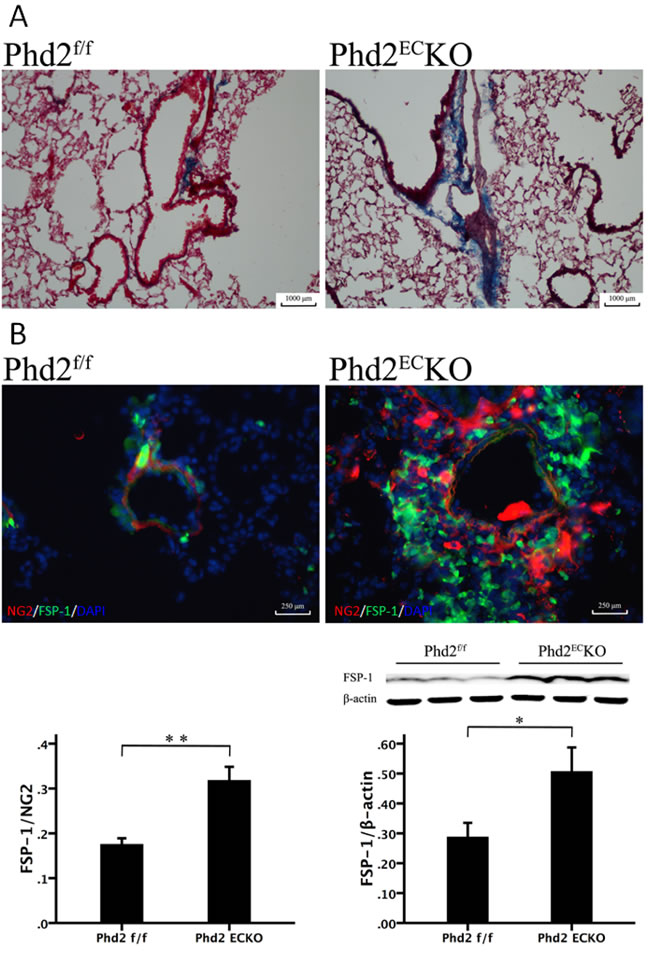 The Relationship between the Pericytes and fibrosis.