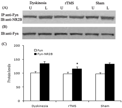 Effects of repetitive transcranial magnetic stimulation (rTMS) treatment on interactions of NR2B with Fyn in dyskinetic rats.