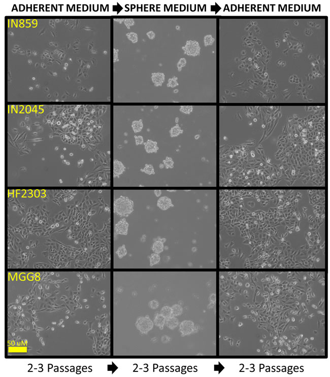 Glioma patient derived glioblastoma cell cultures when cultured in serum containing medium grew as an adherent monolayer.