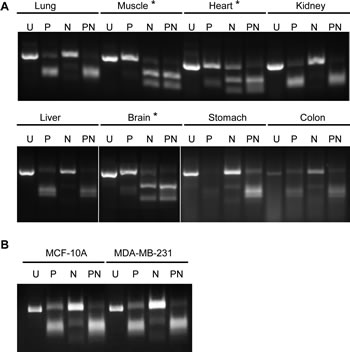 Determination of major PKM isoforms in normal tissues using RT-PCR and restriction enzyme digestion.