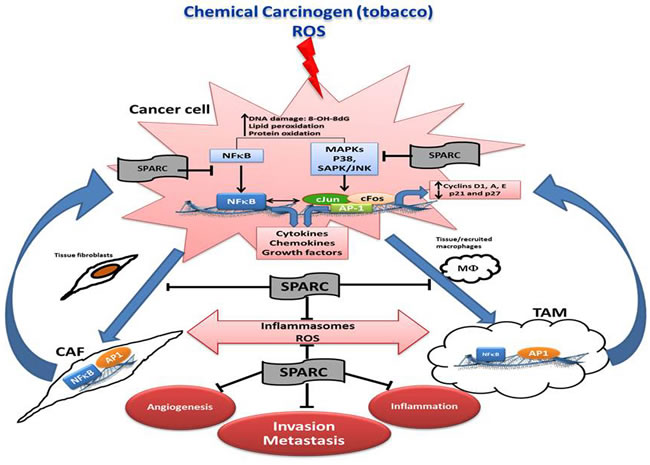 Schematic illustration summarizing the effects of SPARC on the interactions of cancer cells, and stromal cells in the multistep carcinogenesis cascade.