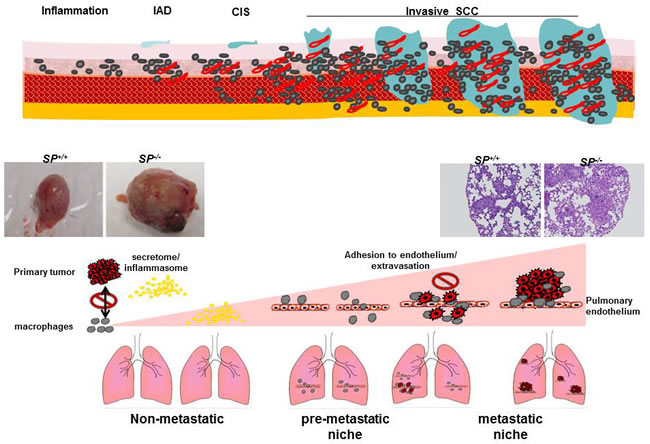 A view of the effect of SPARC on the multistep metastasis cascade and preconditioning pf the metastatic niche.