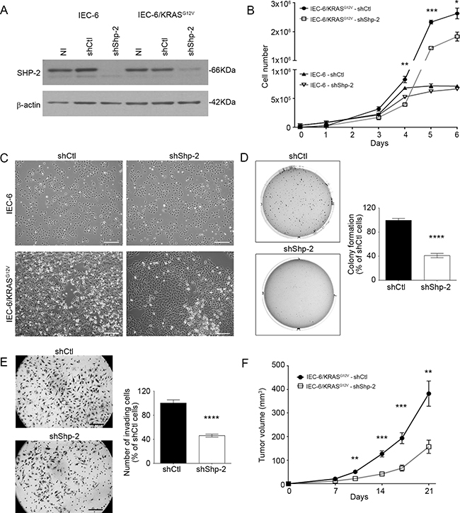 SHP-2 is required for oncogenic activity of KRASG12V in intestinal epithelial cells.