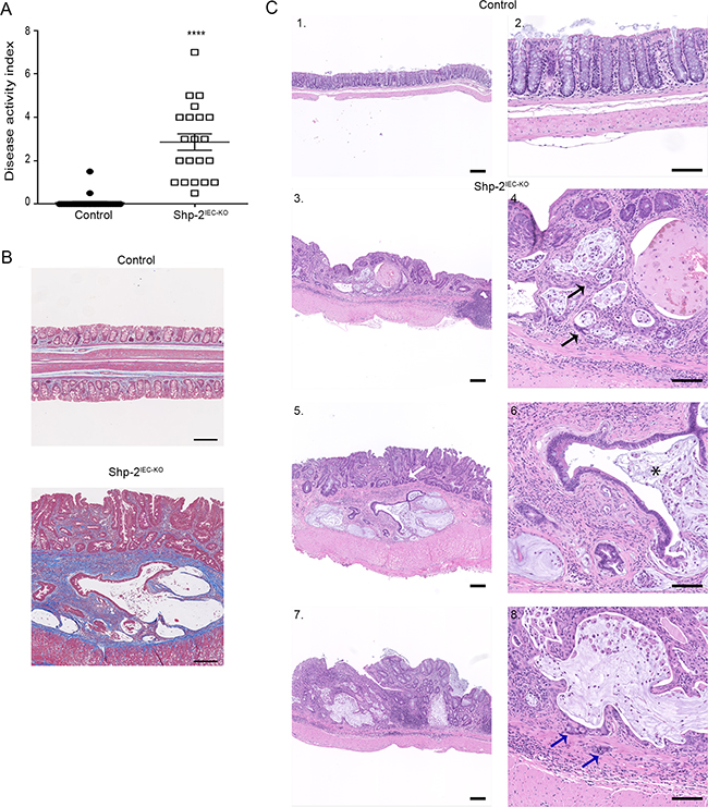 Mice with loss of epithelial SHP-2 expression develop colorectal adenocarcinomas with age.