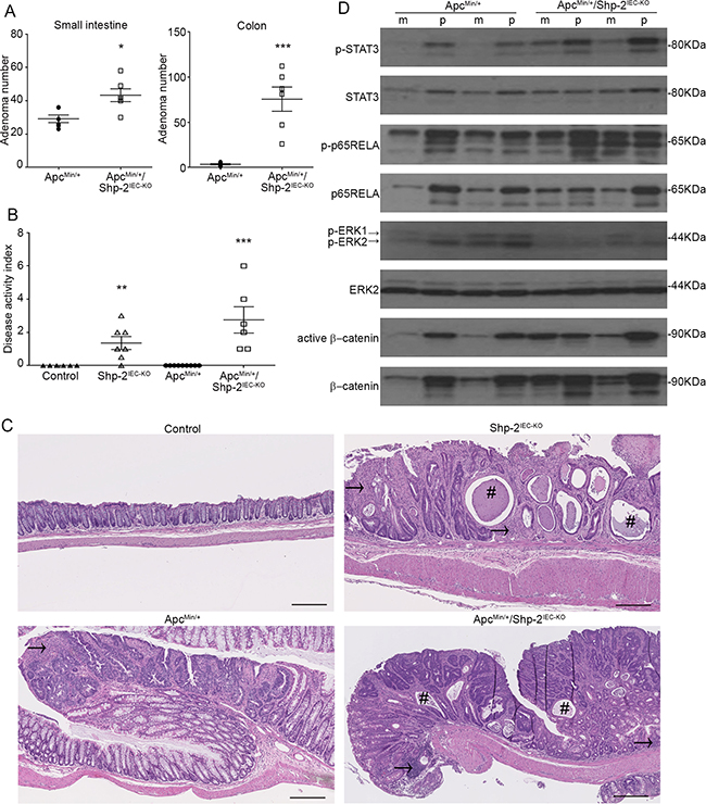 IEC-specific Shp-2 ablation exacerbates tumorigenesis in ApcMin/+ mice.