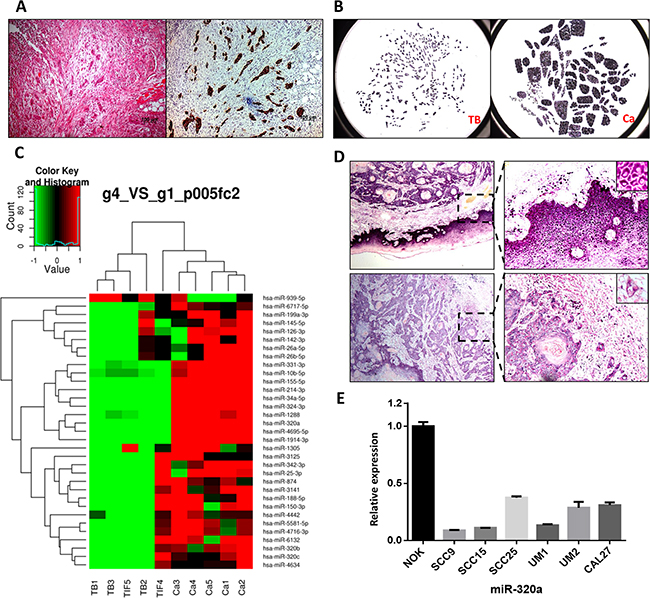 miR-320a is decreased in tumor budding cells of TSCC.