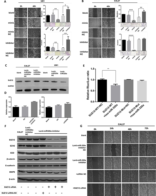 miR-320a suppresses migration and invasion of TSCC cells by targeting Suz12 in vitro.