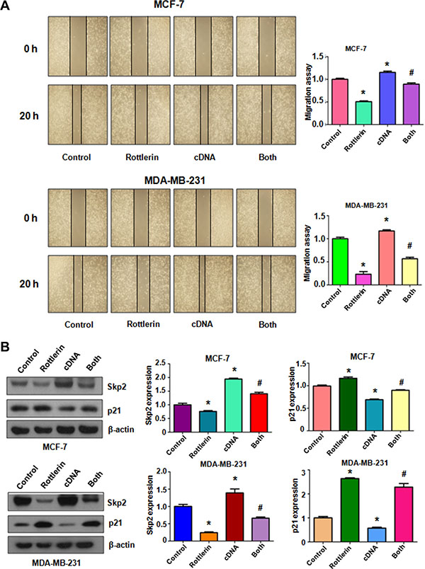 The effect of Skp2 overexpression on cell migration.