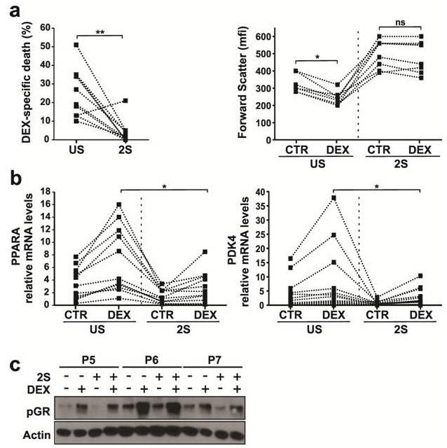 Effect of Dexamethasone on stimulated CLL cells.