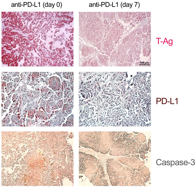 Histological evidence for tumor cell elimination after application of anti-PD-L1 antibodies.