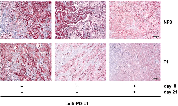 A second PD-L1 antibody treatment eliminates regrown tumors in anti-PD-L1 treated NP8 tumor mice and delays tumor regrowth in T1 tumor mice.