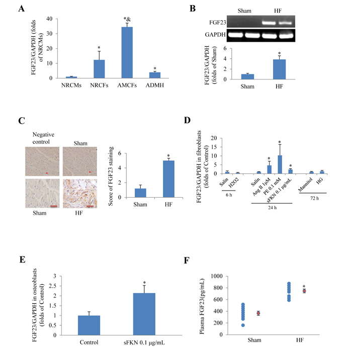 Expression of fibroblast growth factor 23 (FGF23) in rodent cardiac cells.