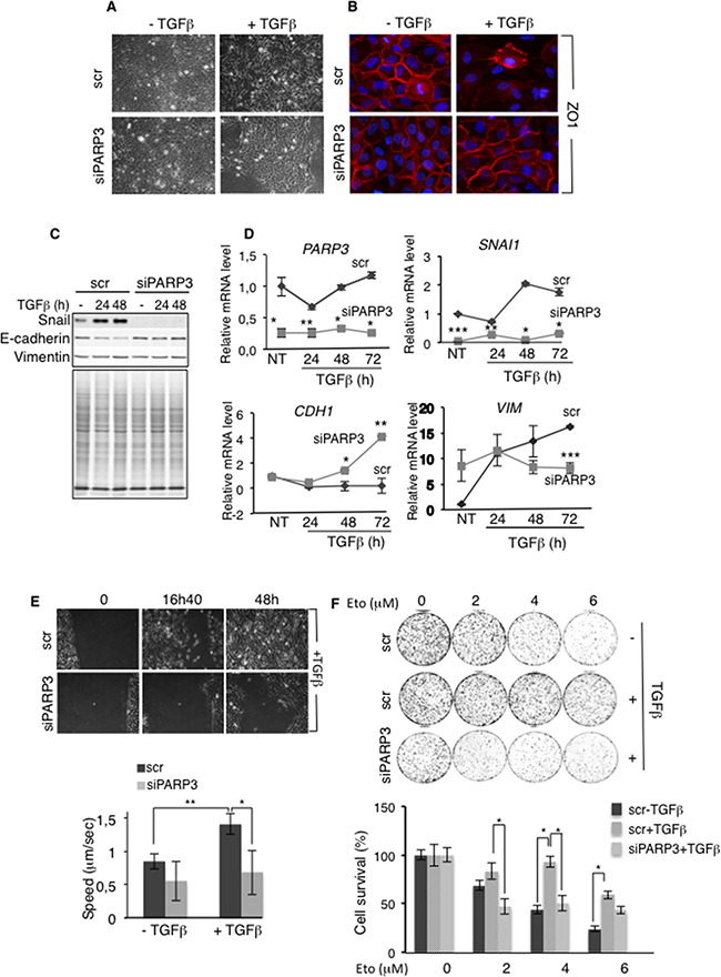 PARP3 silencing impairs TGF&#x03B2;-induced EMT, migration and chemoresistance.
