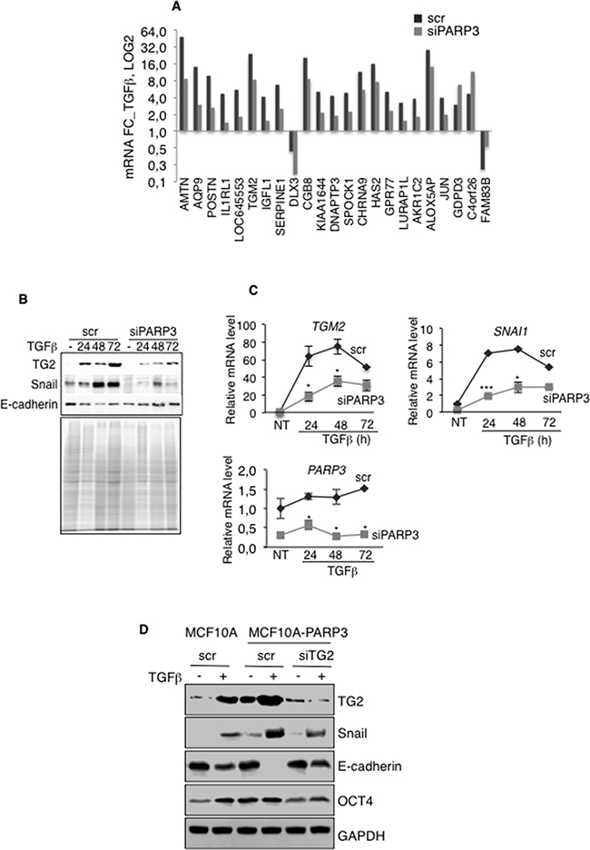 PARP3 promotes TGF&#x03B2;-driven EMT via the regulation of the transglutaminase TG2.