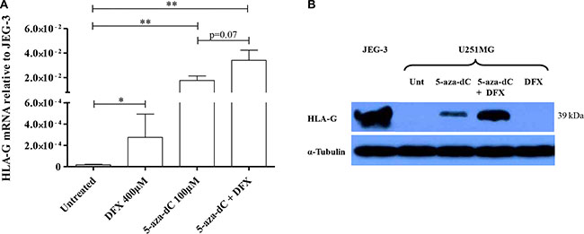 Hypoxia-mimicking conditions induce HLA-G expression in HLA-G negative glioblastoma cell line U251MG.