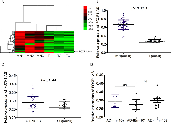 The expression of FOXF1-AS1 was significantly downregulated in lung cancer.