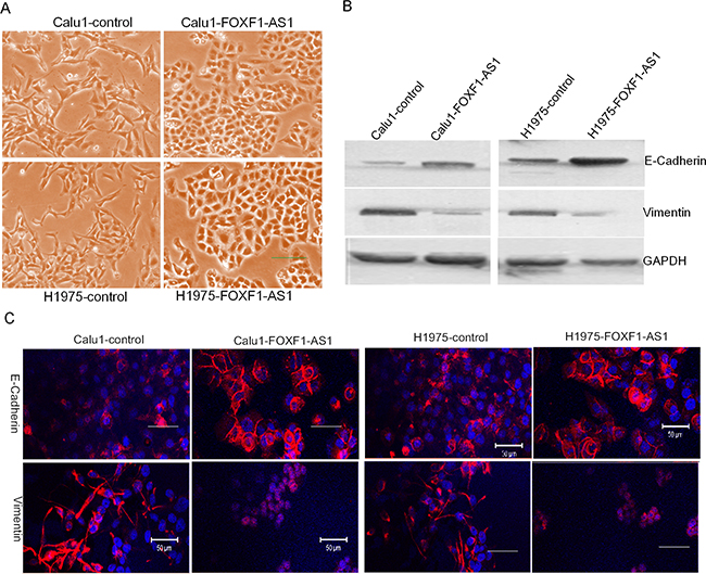 FOXF1-AS1 regulated epithelial-mesenchymal transition in lung cancer cells.